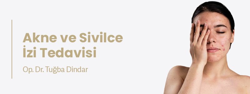 Akne ve Sivilce İzi Tedavisi