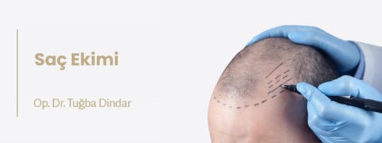 Saç Ekimi