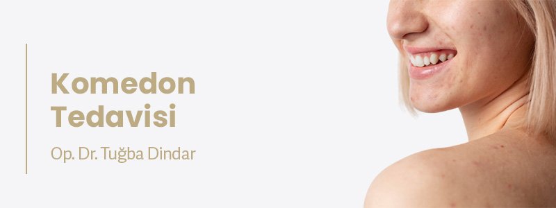 Komedon Tedavisi
