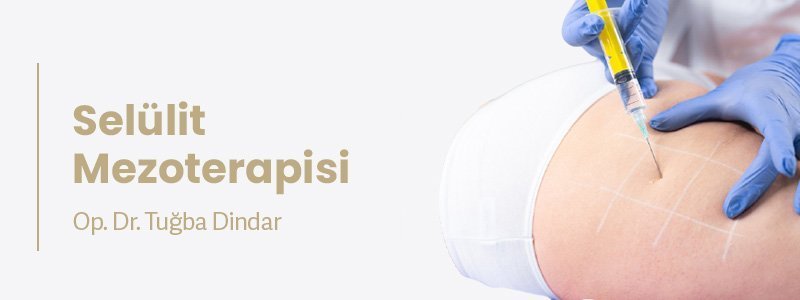Selülit Mezoterapisi