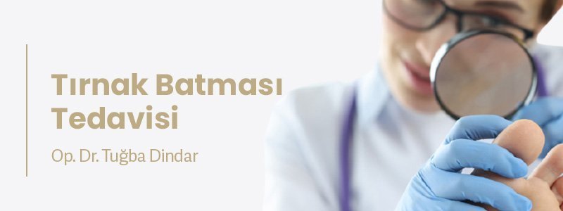 Tırnak Batması Tedavisi