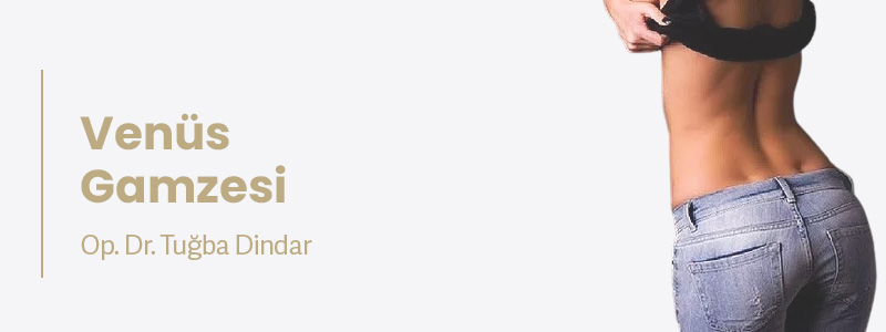 Venüs Gamzesi, Bel Gamzesi Estetiği